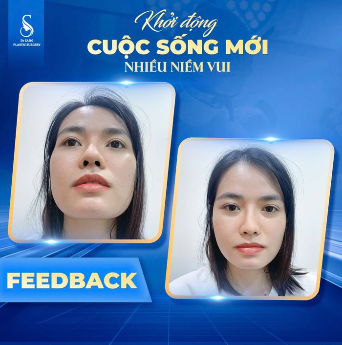 Combo siêu phẫu toàn diện